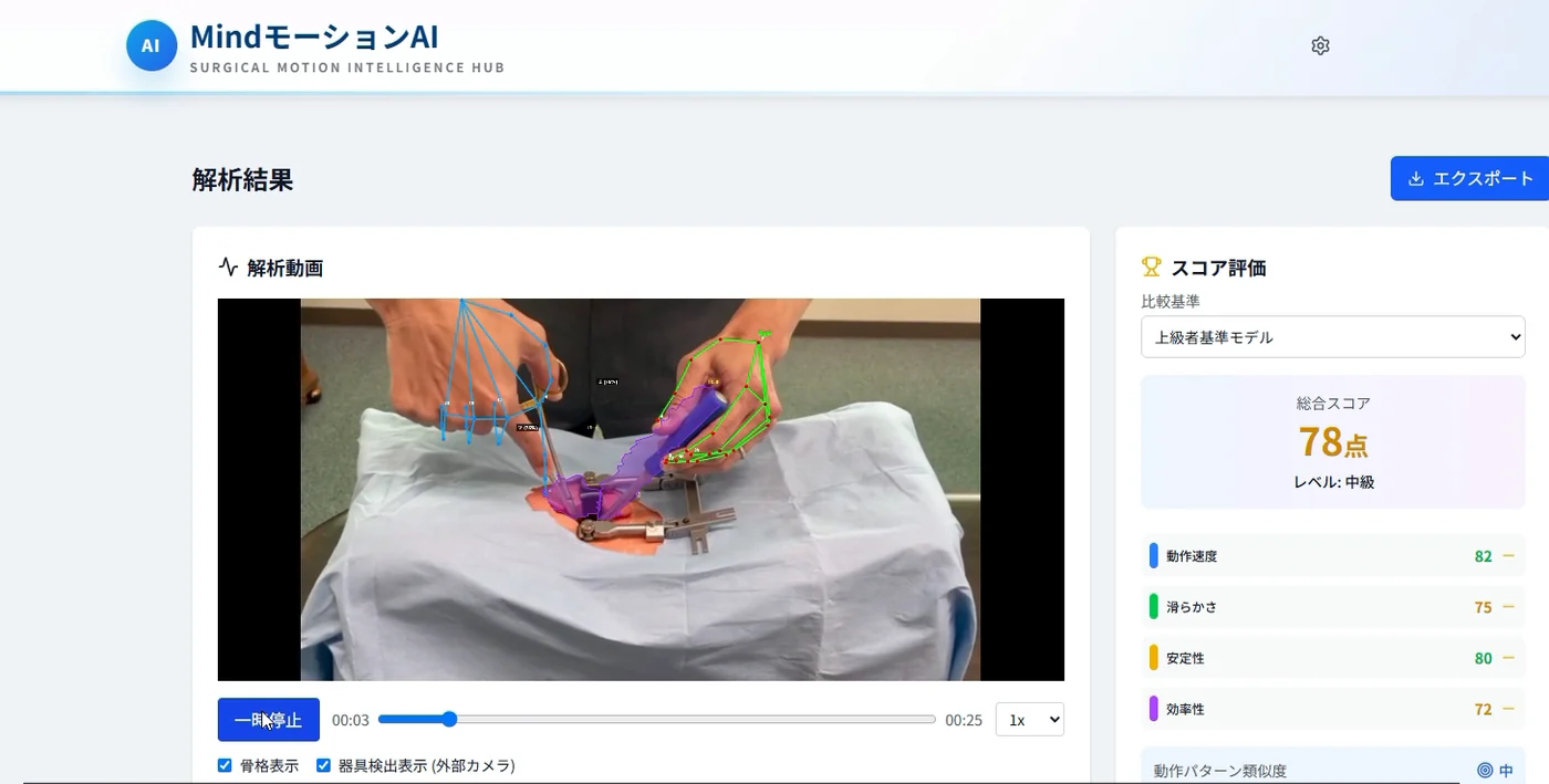MindMotionAI の解析ダッシュボード。手技・器具の動き分析とフィードバックを表示